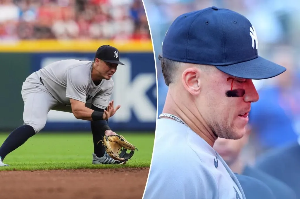 Aaron Judge Berdarah Kena Lemparan Anthony Volpe
